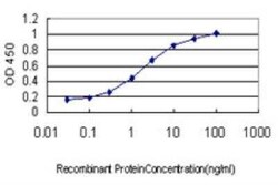 Profilin 2 Antibody (5F11), Novus Biologicals 0.1 mg | Buy Online | Novus Biologicals | Fisher Scientific