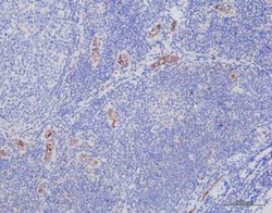Progesterone Antibody (6-5E-10B), Novus Biologicals:Antibodies:Primary
