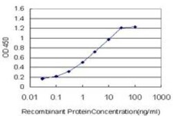 Progesterone R/NR3C3 Antibody (4E9), Novus Biologicals 0.1 mg | Buy Online | Novus Biologicals | Fisher Scientific