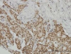 Progesterone R/NR3C3 Antibody (4E9), Novus Biologicals 0.1 mg | Buy Online | Novus Biologicals | Fisher Scientific