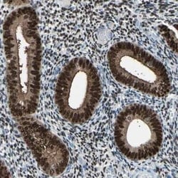 Progesterone R/NR3C3 Antibody, Novus Biologicals 25 &mu;L; Unconjugated:Antibodies,