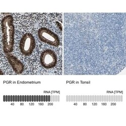 Progesterone R/NR3C3 Antibody, Novus Biologicals 25 &mu;L; Unconjugated:Antibodies,
