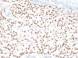 Progesterone R/NR3C3 Antibody (PR500), Novus Biologicals:Antibodies:Primary