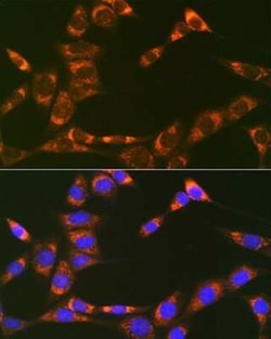 Prohibitin 2 Rabbit anti-Human, Mouse, Rat, Clone: 8I10B1, Novus Biologicals