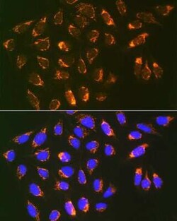 Prohibitin 2 Rabbit anti-Human, Mouse, Rat, Clone: 8I10B1, Novus Biologicals