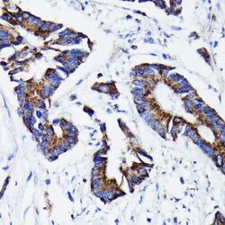 Prohibitin Rabbit anti-Human, Mouse, Rat, Clone: 0V2R10, Novus Biologicals