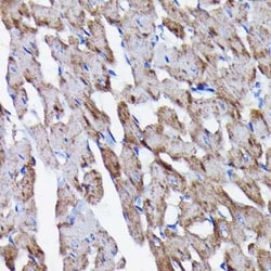 Prohibitin Rabbit anti-Human, Mouse, Rat, Clone: 0V2R10, Novus Biologicals