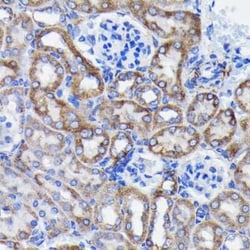 Prohibitin Rabbit anti-Human, Mouse, Rat, Clone: 0V2R10, Novus Biologicals