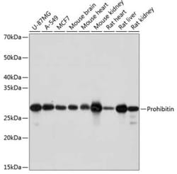 Prohibitin Rabbit anti-Human, Mouse, Rat, Clone: 0V2R10, Novus Biologicals