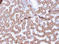 Prohibitin Antibody (PHB/3225) - Azide and BSA Free, Novus Biologicals