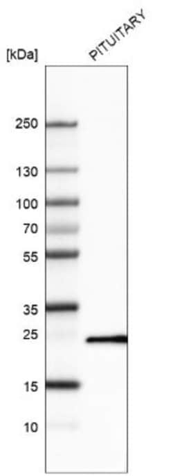 Prolactin Antibody (CL6550), Novus Biologicals:Antibodies:Primary Antibodies