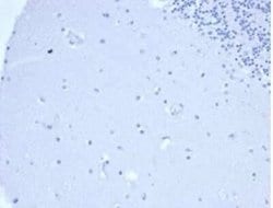 Prolactin Rabbit anti-Human, Clone: PRL/4906R, Novus Biologicals:Antibodies:Primary