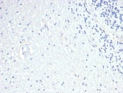 Prolactin Rabbit anti-Human, Clone: PRL/4908R, Novus Biologicals:Antibodies:Primary