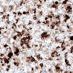 Prolactin Antibody (CL6559), Novus Biologicals 100 &mu;L | Buy Online | Novus Biologicals | Fisher Scientific