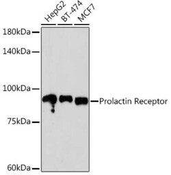 Prolactin R Rabbit anti-Human, Mouse, Rat, Clone: 9B10J3, Novus Biologicals 20 &mu;g | Buy Online | Novus Biologicals | Fisher Scientific