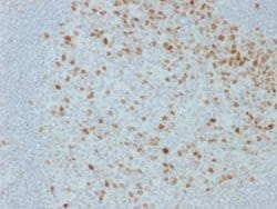 Proliferation Marker Mouse anti-Human, Clone: JC1, Novus Biologicals 20