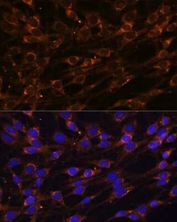 Prolyl endopeptidase-like Antibody - Azide and BSA Free, Novus Biologicals