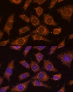 Prolyl endopeptidase-like Antibody - Azide and BSA Free, Novus Biologicals