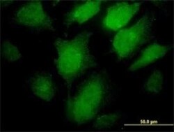 Proprotein Convertase 1/PCSK1 Antibody (3D2), Novus Biologicals 0.1 mg | Buy Online | Novus Biologicals | Fisher Scientific
