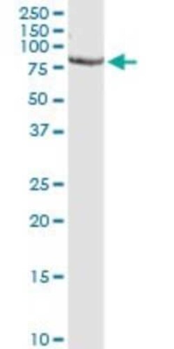 Proprotein Convertase 1/PCSK1 Antibody (3D2), Novus Biologicals 0.1 mg | Buy Online | Novus Biologicals | Fisher Scientific