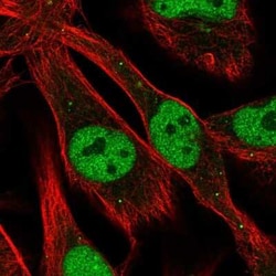 Proprotein Convertase 2/PCSK2 Antibody, Novus Biologicals:Antibodies:Primary