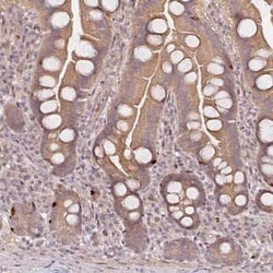 Proprotein Convertase 2/PCSK2 Antibody, Novus Biologicals:Antibodies:Primary