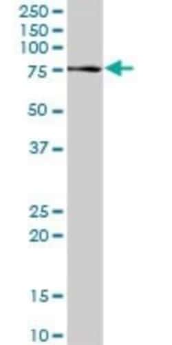 Proprotein Convertase 2/PCSK2 Antibody, Novus Biologicals 0.1 mg | Buy Online | Novus Biologicals | Fisher Scientific