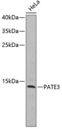 Prostate and testis expressed protein 3 Antibody - BSA Free, Novus Biologicals:Antibodies:Primary