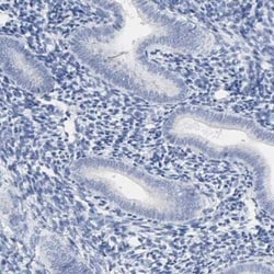 Prostatic Acid Phosphatase/ACPP Antibody, Novus Biologicals:Antibodies:Primary