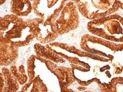 Prostatic Acid Phosphatase/ACPP Antibody (SPM312), Novus Biologicals 100&mu;g;