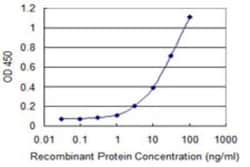 Prosurfactant Protein C Antibody (4A10), Novus Biologicals 0.1 mg | Buy Online | Novus Biologicals | Fisher Scientific