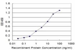 Protease Inhibitor 15 Antibody (3B5), Novus Biologicals 0.1 mg | Buy Online | Novus Biologicals | Fisher Scientific