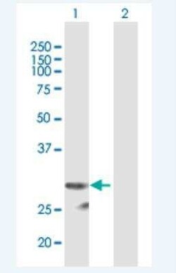 Protease Inhibitor 15 Antibody, Novus Biologicals 50 &mu;g | Buy Online | Novus Biologicals | Fisher Scientific