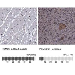 Proteasome 19S 10B Rabbit anti-Human, Polyclonal, Novus Biologicals 25