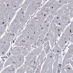Proteasome 19S 10B Rabbit anti-Human, Polyclonal, Novus Biologicals 25