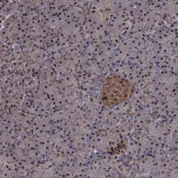 Proteasome 19S 10B Rabbit anti-Human, Polyclonal, Novus Biologicals 25