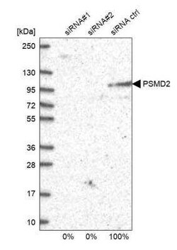Proteasome 19S 10B Antibody, Novus Biologicals:Antibodies:Primary Antibodies
