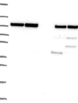 Proteasome 19S 10B Rabbit anti-Human, Polyclonal, Novus Biologicals 25