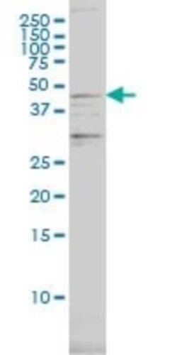 Proteasome 19S S7 Antibody (4C10-2C8), Novus Biologicals 0.1 mg | Buy Online | Novus Biologicals | Fisher Scientific