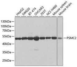 Proteasome 19S S7 Antibody - BSA Free, Novus Biologicals 0.1 mL | Buy Online | Novus Biologicals | Fisher Scientific
