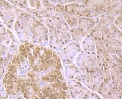 Proteasome 20S C2 Rabbit anti-Human, Mouse, Rat, Clone: JB89-30, Novus