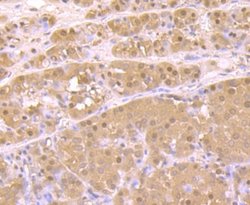 Proteasome 20S C2 Rabbit anti-Human, Mouse, Rat, Clone: JB89-30, Novus