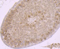 Proteasome 20S C2 Rabbit anti-Human, Mouse, Rat, Clone: JB89-30, Novus