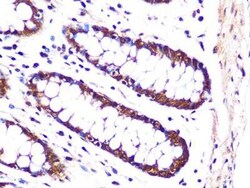Proteasome 20S alpha 3 Rabbit anti-Human, Mouse, Rat, Clone: 7X8W9, Novus