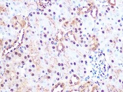 Proteasome 20S alpha 3 Rabbit anti-Human, Mouse, Rat, Clone: 7X8W9, Novus