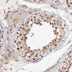 Proteasome 20S alpha 6 Antibody, Novus Biologicals:Antibodies:Primary Antibodies
