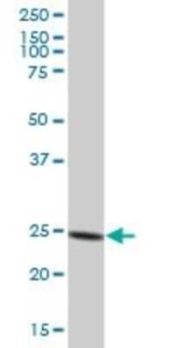 Proteasome 20S alpha 6 Antibody, Novus Biologicals 50 &mu;g | Buy Online | Novus Biologicals | Fisher Scientific