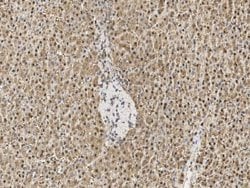 Proteasome 20S beta 6 Rabbit anti-Human, Polyclonal, Novus Biologicals 50 &mu;g | Buy Online | Novus Biologicals | Fisher Scientific