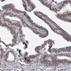Proteasome 20S beta2 Antibody, Novus Biologicals:Antibodies:Primary Antibodies