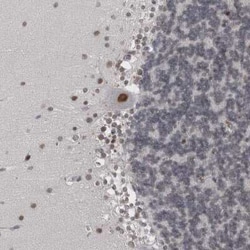 Proteasome 20S beta2 Antibody, Novus Biologicals:Antibodies:Primary Antibodies